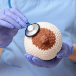 A presença de nódulo na mama pode exigir mamografia para esclarecer o diagnóstico com mais precisão, explica Vinicius Tadeu Sattin Rodrigues.