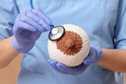 A presença de nódulo na mama pode exigir mamografia para esclarecer o diagnóstico com mais precisão, explica Vinicius Tadeu Sattin Rodrigues.