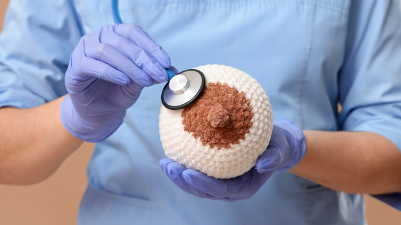 A presença de nódulo na mama pode exigir mamografia para esclarecer o diagnóstico com mais precisão, explica Vinicius Tadeu Sattin Rodrigues.